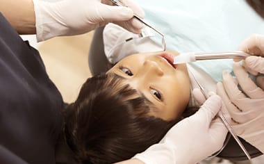 むし歯の治療イメージ