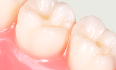 シーラントイメージ